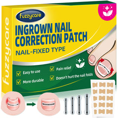 Fuzzycare kit tratamiento uñas encarnadas de titanio para alivio posible