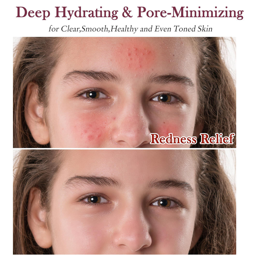 GEBEATY mascarilla de arcilla limpia en profundidad y desintoxica poros.