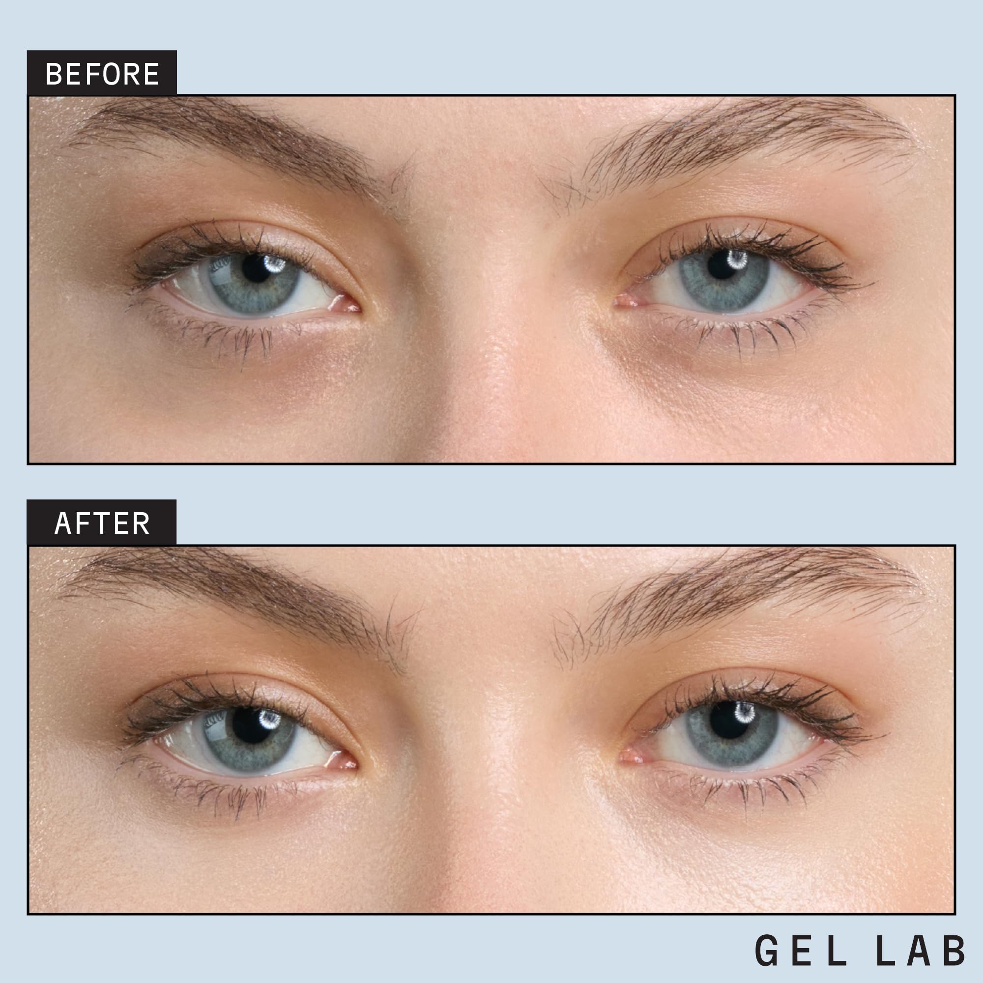 Gel Lab REGLOW parches oculares con ácido hialurónico para hidratación profunda