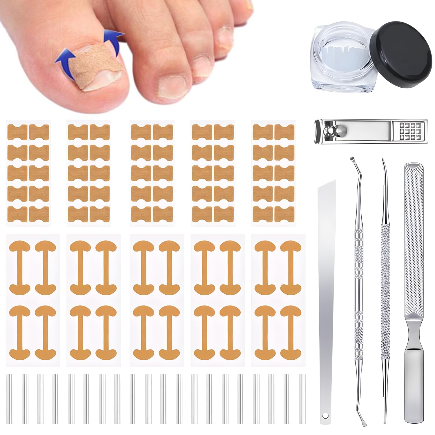 Generic corrector de uñas encarnadas: kit completo para cuidado en casa