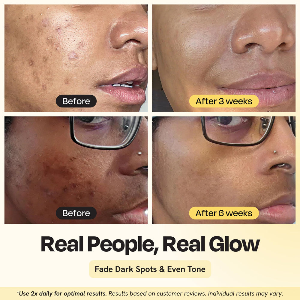 Gleamin crema facial hidratación profunda en frasco, ideal para piel seca.