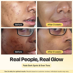 Gleamin crema facial hidratación profunda en frasco, ideal para piel seca.