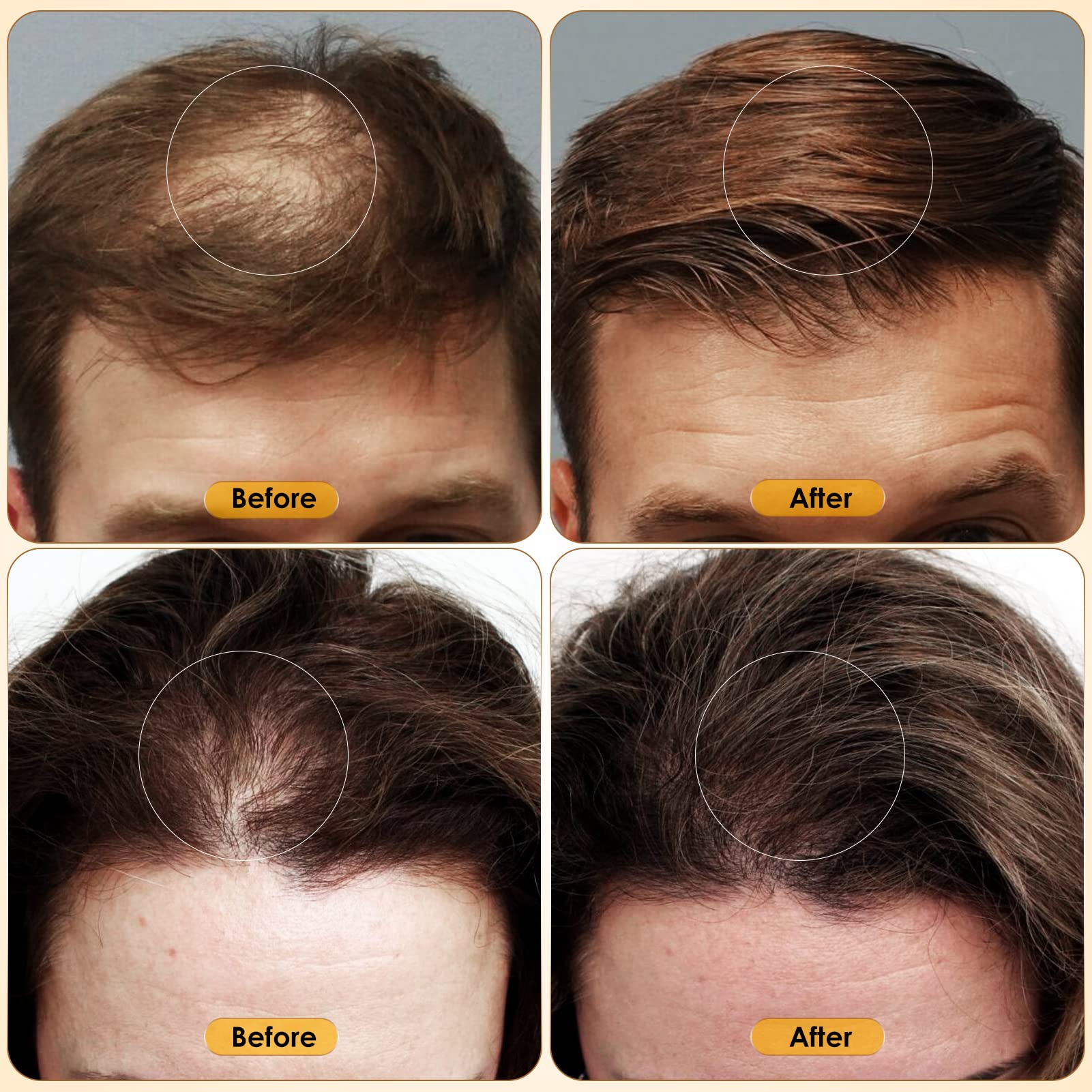 Glemme rutina cabello diaria: dosis rápida para resultados sostenibles.