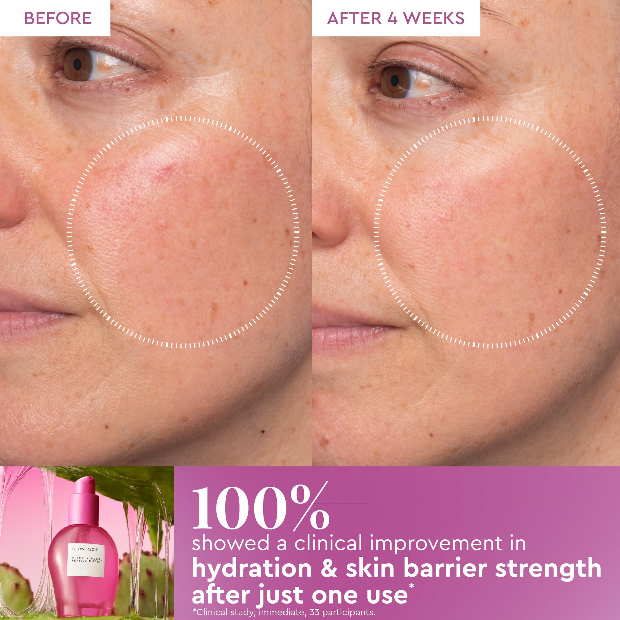 Glow Recipe Prickly Pear Peptide Mucin: detalle de poros más refinados tras uso constante