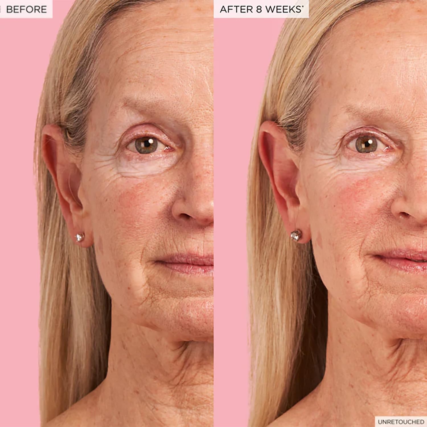 Peau hydratée et lumineuse après l'application du sérum.