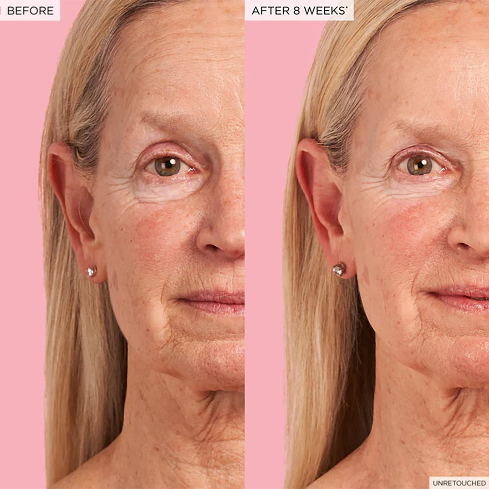 Peau hydratée et lumineuse après l'application du sérum.