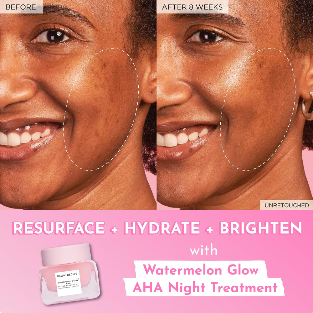 Aplicación suave de Glow Recipe Watermelon Glow Night Treatment antes de dormir.