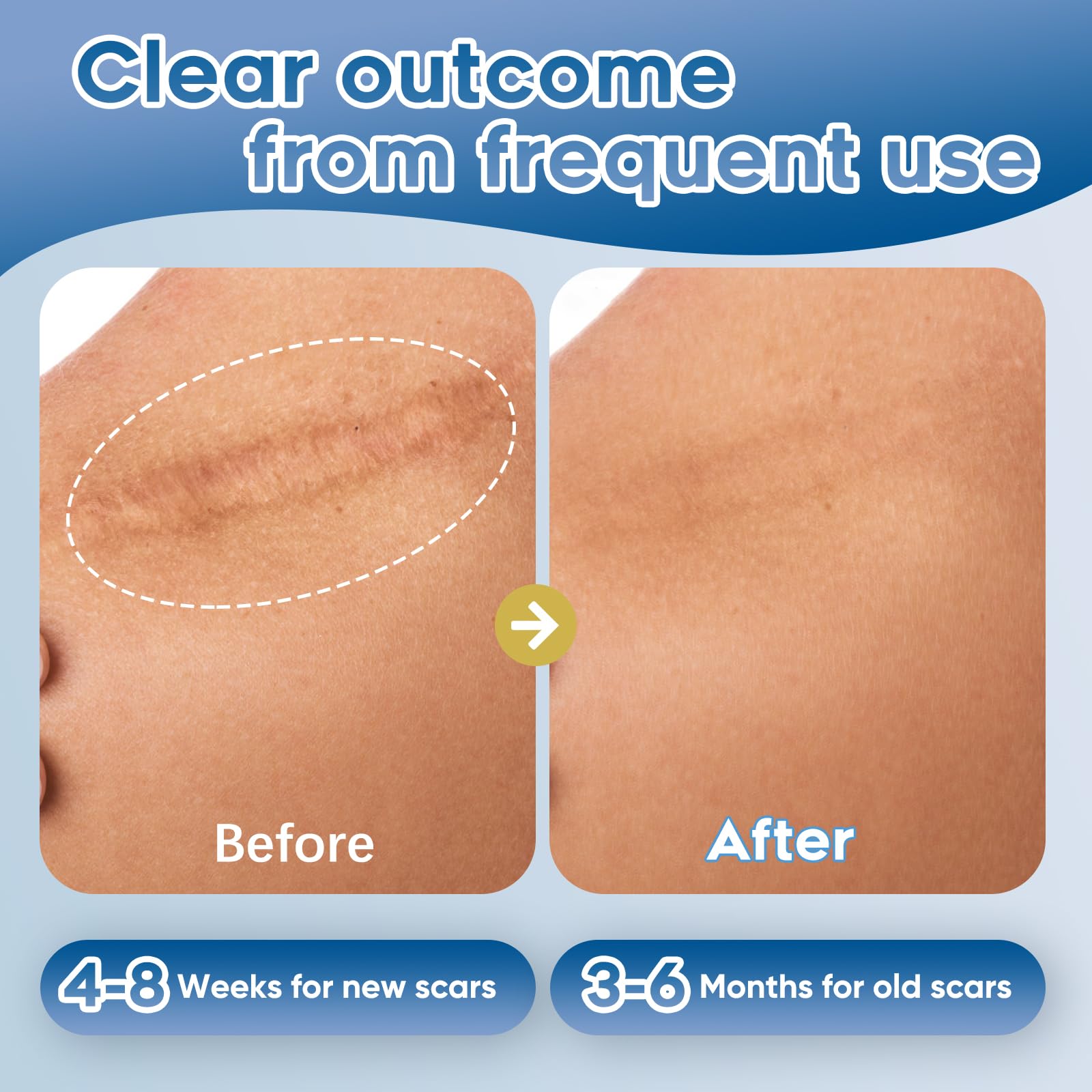 Glowor uso facial y corporal, seguro para piel sensible.