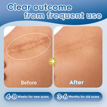 Glowor uso facial y corporal, seguro para piel sensible.