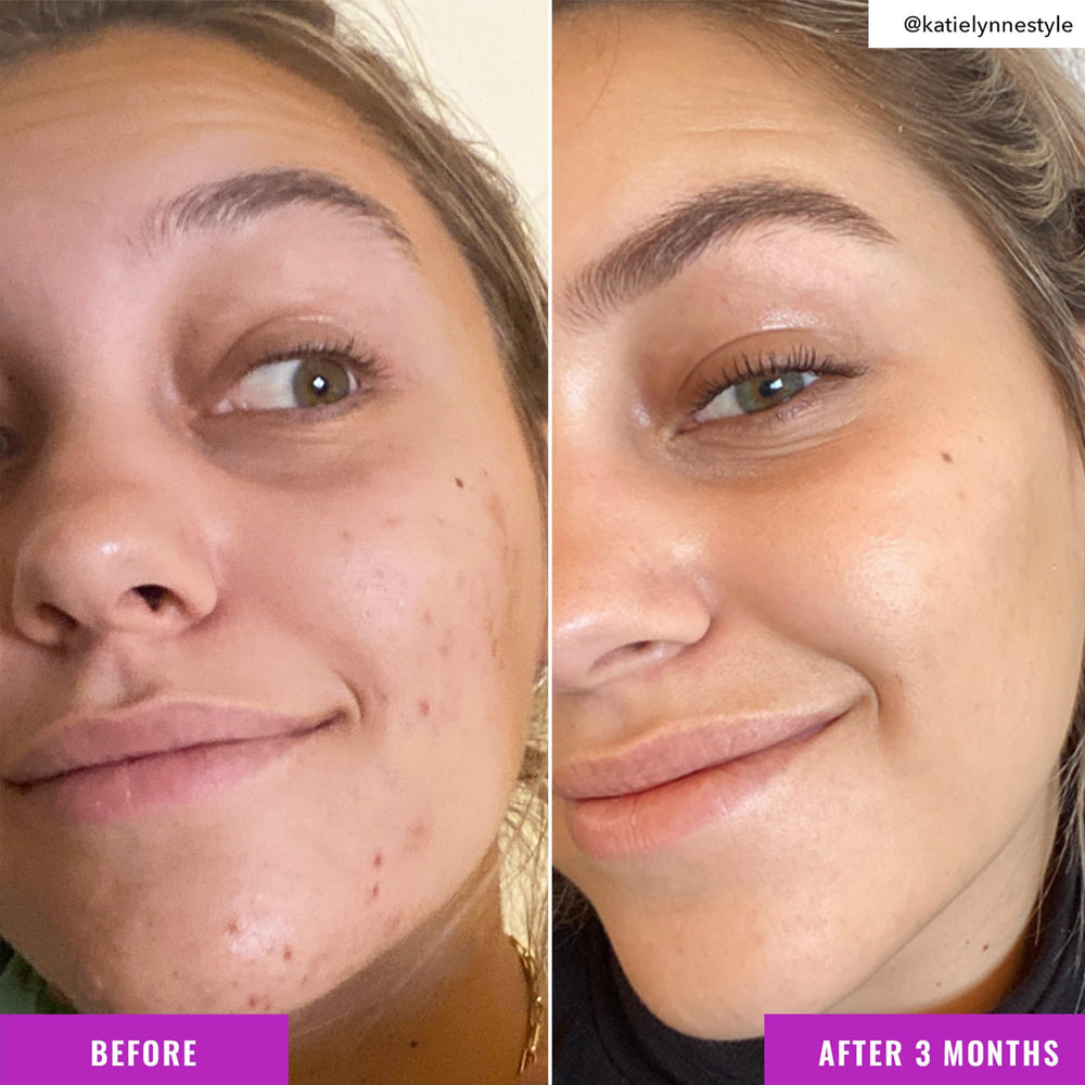 Uso diario con Good Molecules para cuidado facial suave.