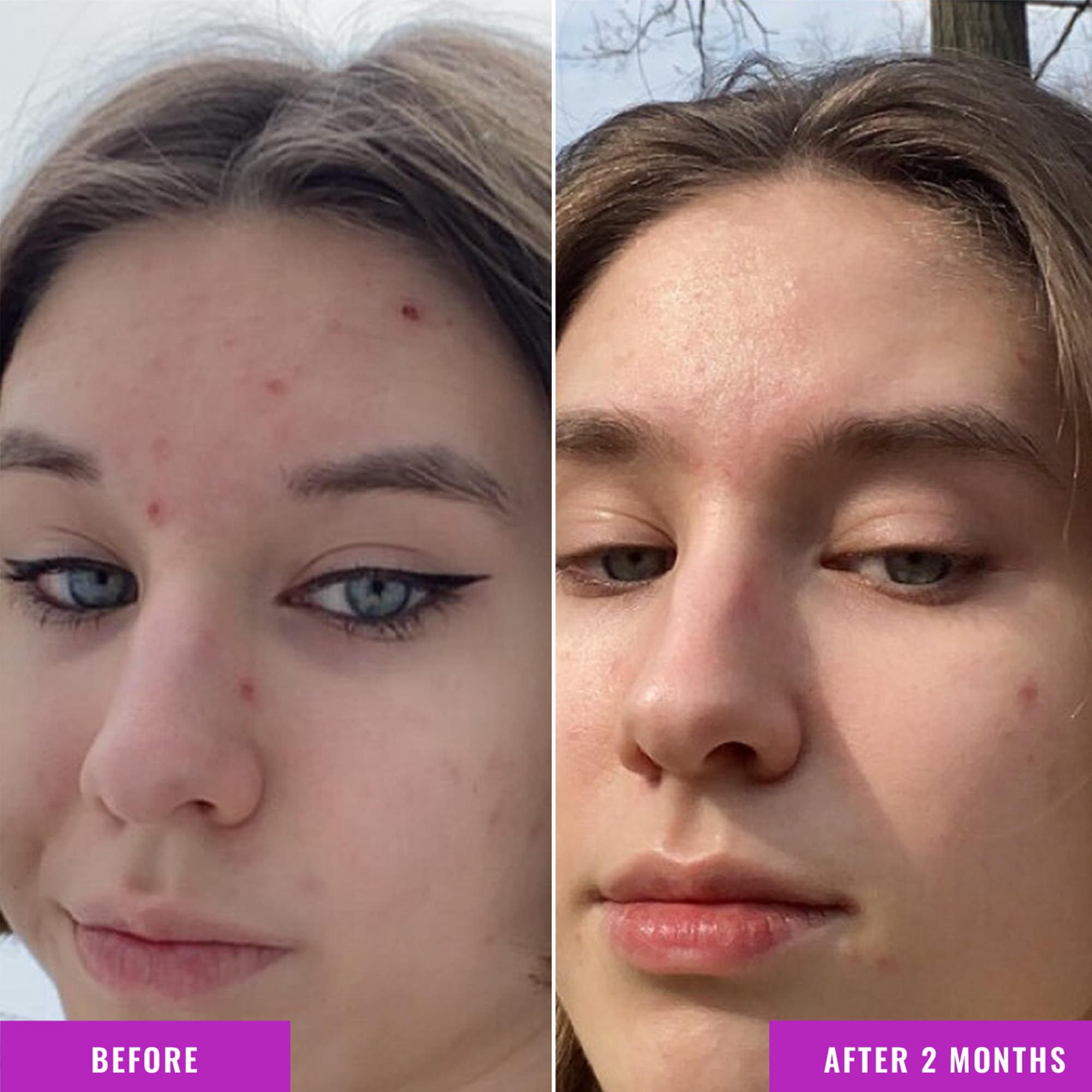 Botella de Good Molecules Niacinamide Serum en baño con luz natural.