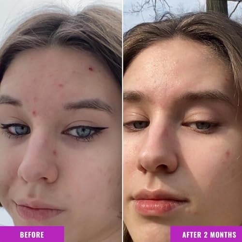 Good Molecules Niacinamide Serum Pack 2: poros visibles reducidos con uso constante