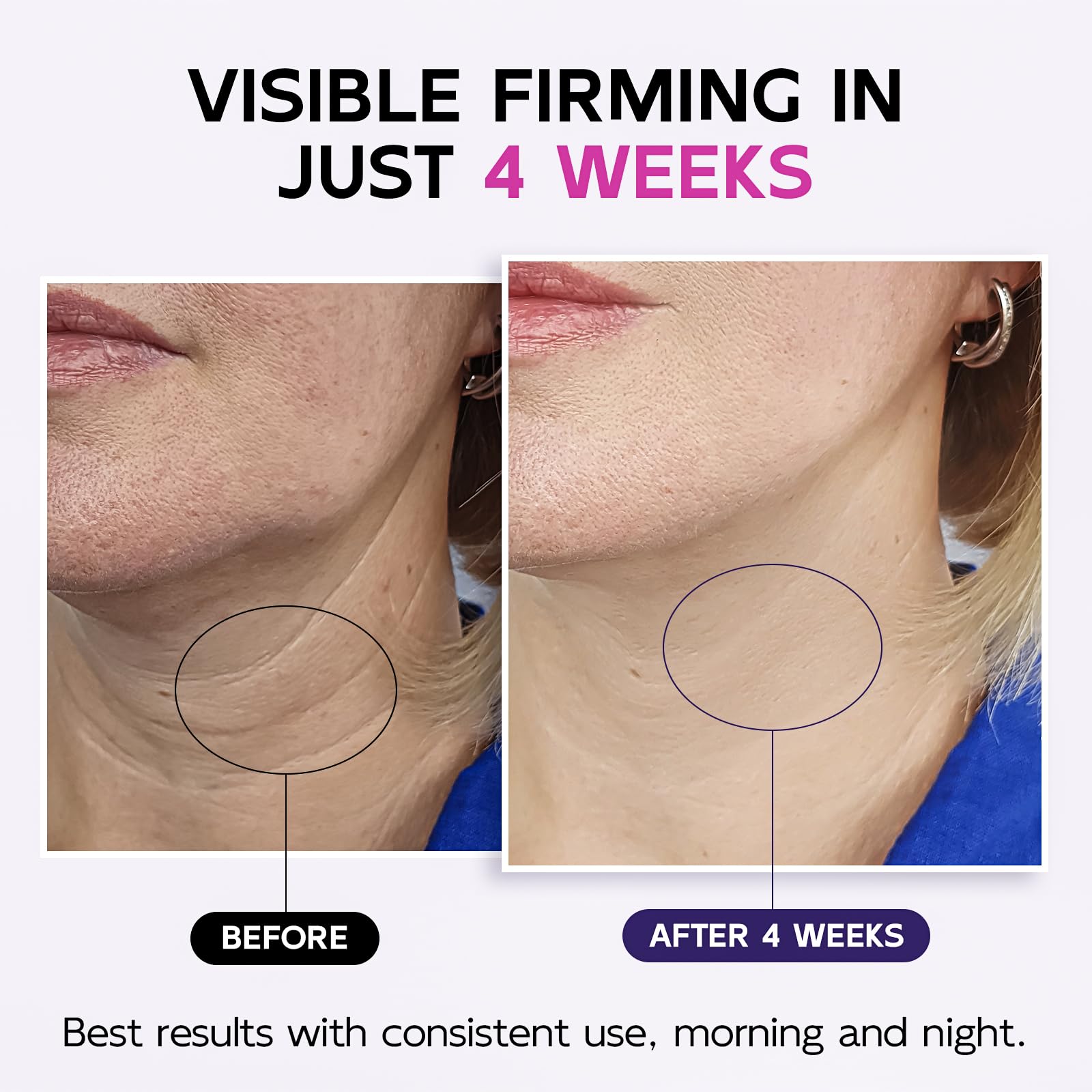 GOOSURE crema cuello: textura suave que apoya hidratación profunda