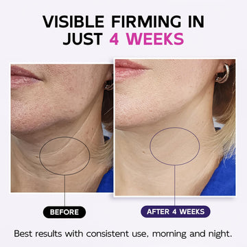 GOOSURE crema cuello: textura suave que apoya hidratación profunda