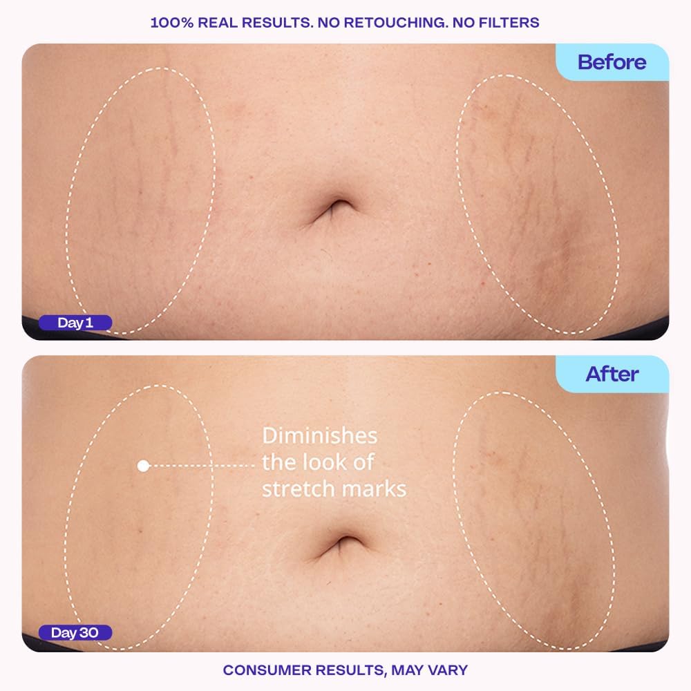 goPure crema abdomen efecto firmeza: apariencia más tonificada con uso constante.