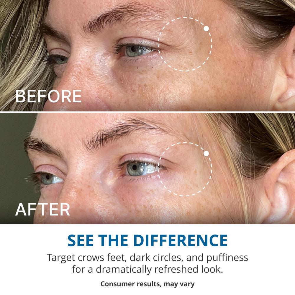 goPure Crema de Ojos con Ingredientes Naturales Concentrados: cuidado diario