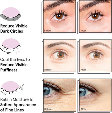Niacinamida grace & stella para iluminación suave alrededor de los ojos