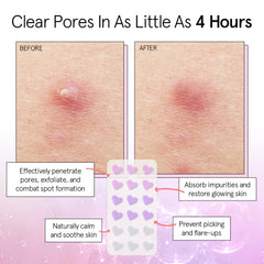 Parche Grace & Stella con corazón violeta disimula imperfecciones discretamente