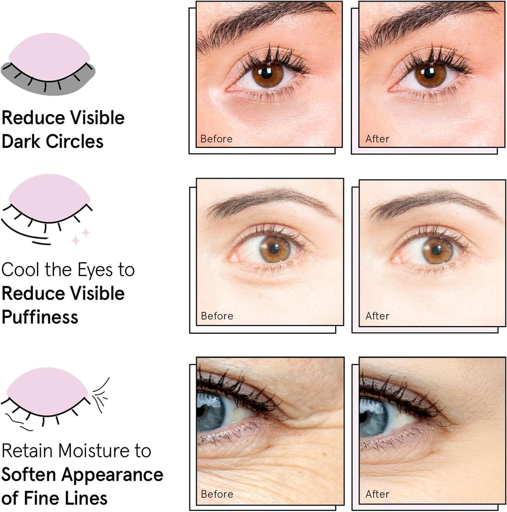 Grace & Stella parche ojos piel sensible: cuidado suave para la zona inferior