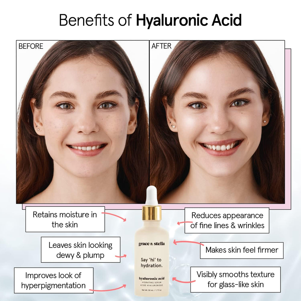 Grace & Stella serum acido hialuronico, textura ligera apta para todo tipo de piel.