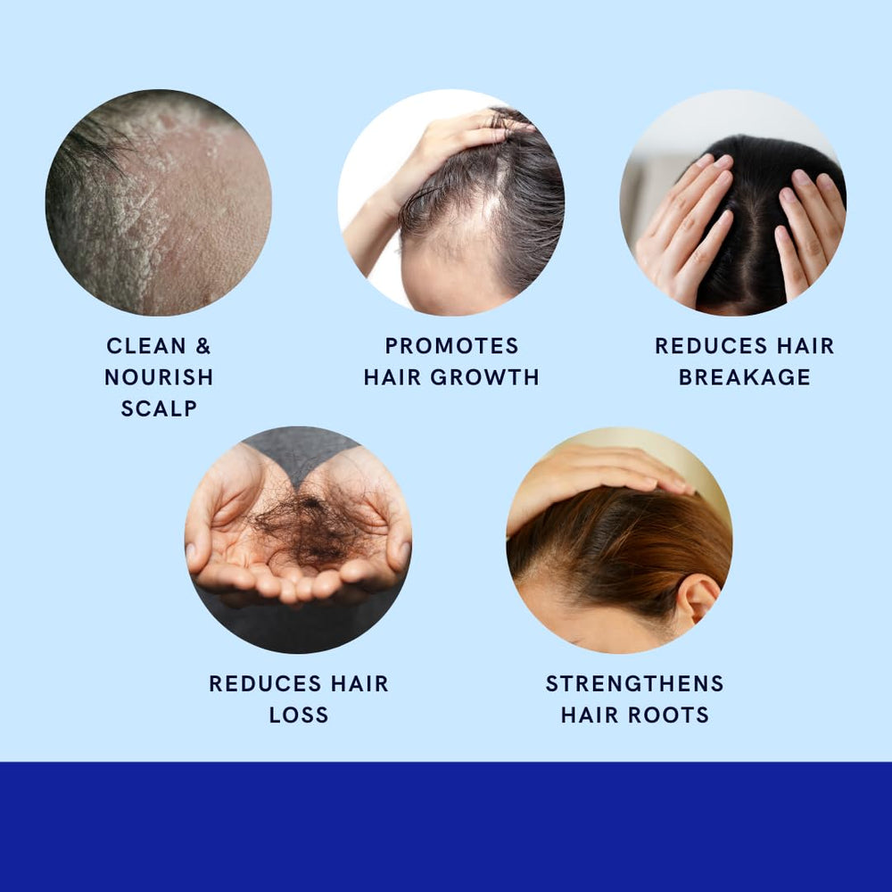 GREEN ROYALTY Minoxidil Champú – envase grande de 950 ml para uso prolongado.