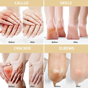 Grocerism Oat Urea Cream targets calluses for softer skin