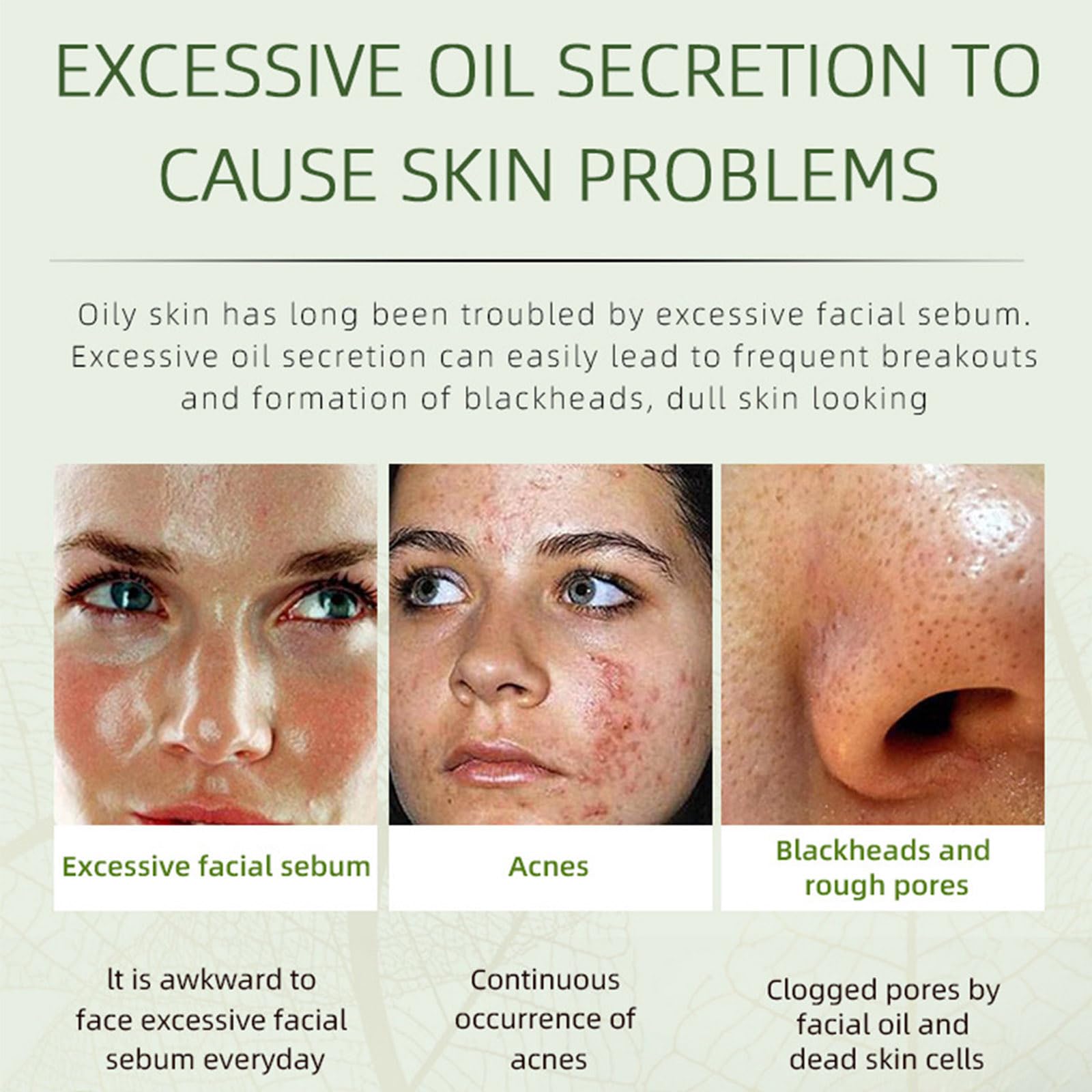 Grospe crema antiacné con extractos herbales para piel clara