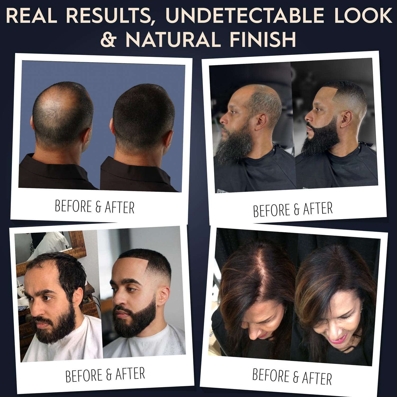 Hair Illusion sans composants synthétiques, fibres naturelles pour un rendu discret.
