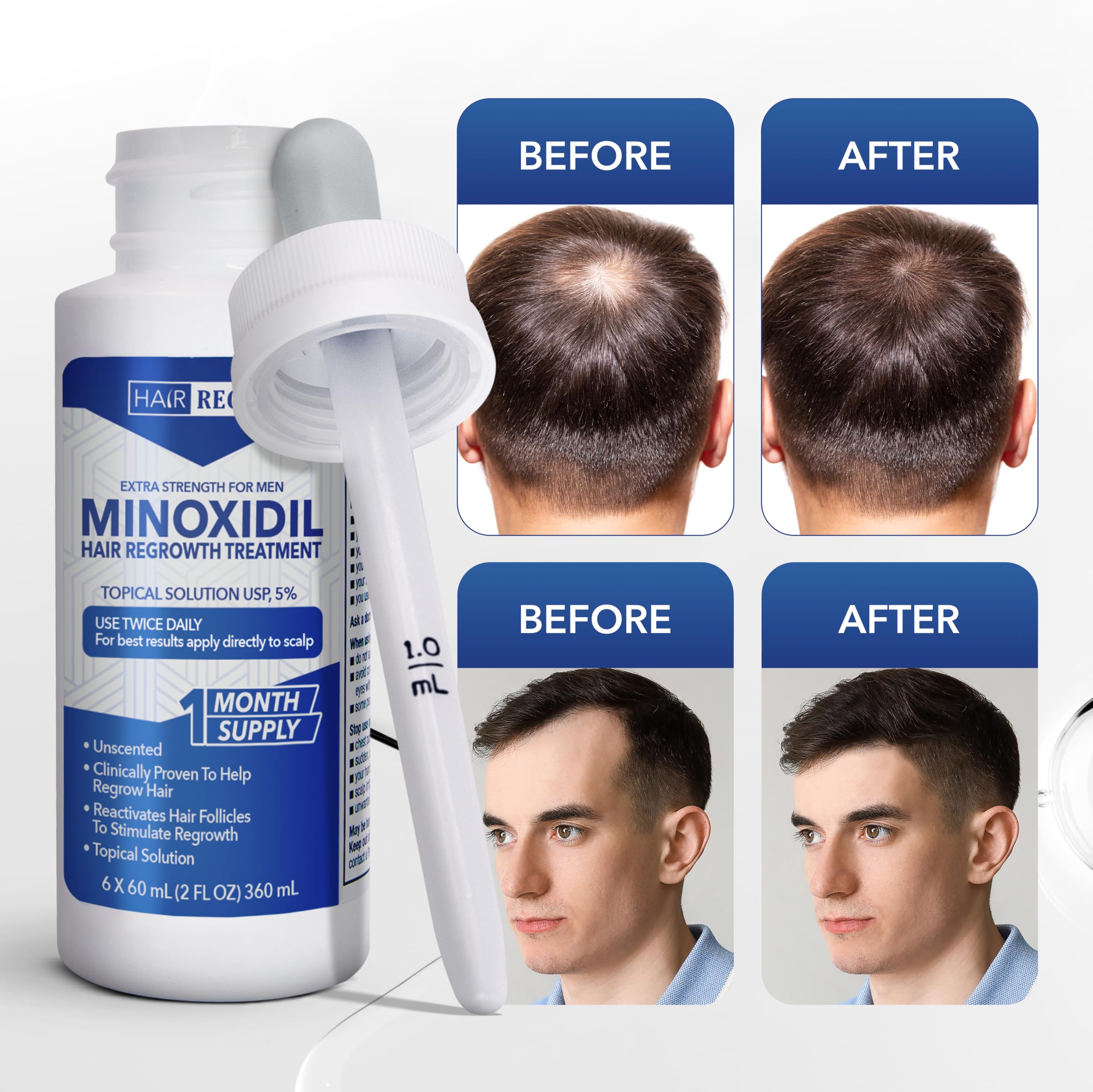 Hair Regen Minoxidilo 5% aplicación en cuero cabelludo con guía
