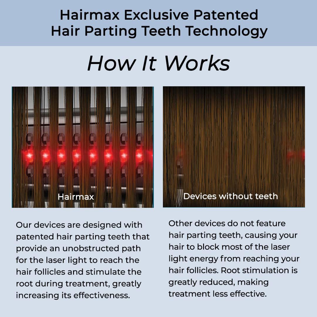 Hairmax Ultima 12 Clásico, embalaje y accesorios para inicio rápido.