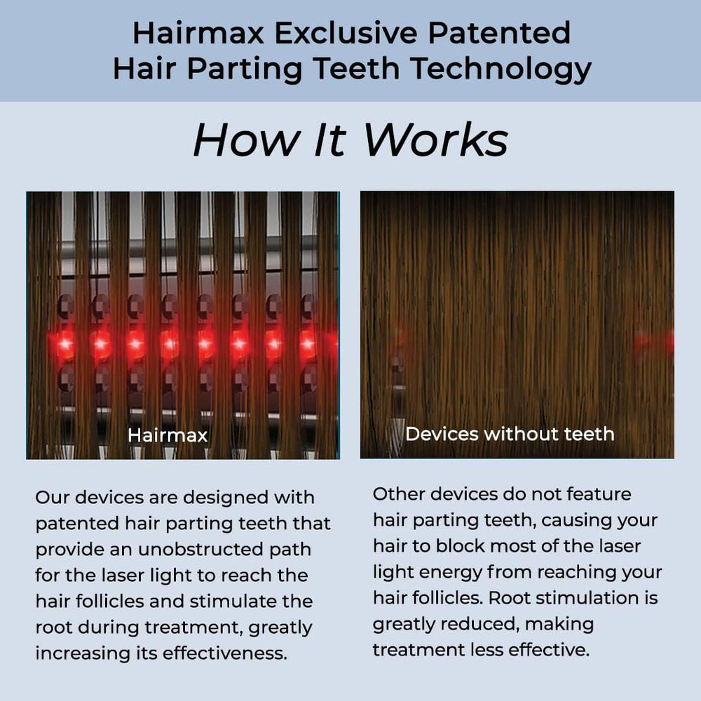 Hairmax Ultima 12 Clásico, embalaje y accesorios para inicio rápido.