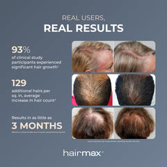 Hairmax Ultima 9 Clásica uso sin cables para casa o viaje.