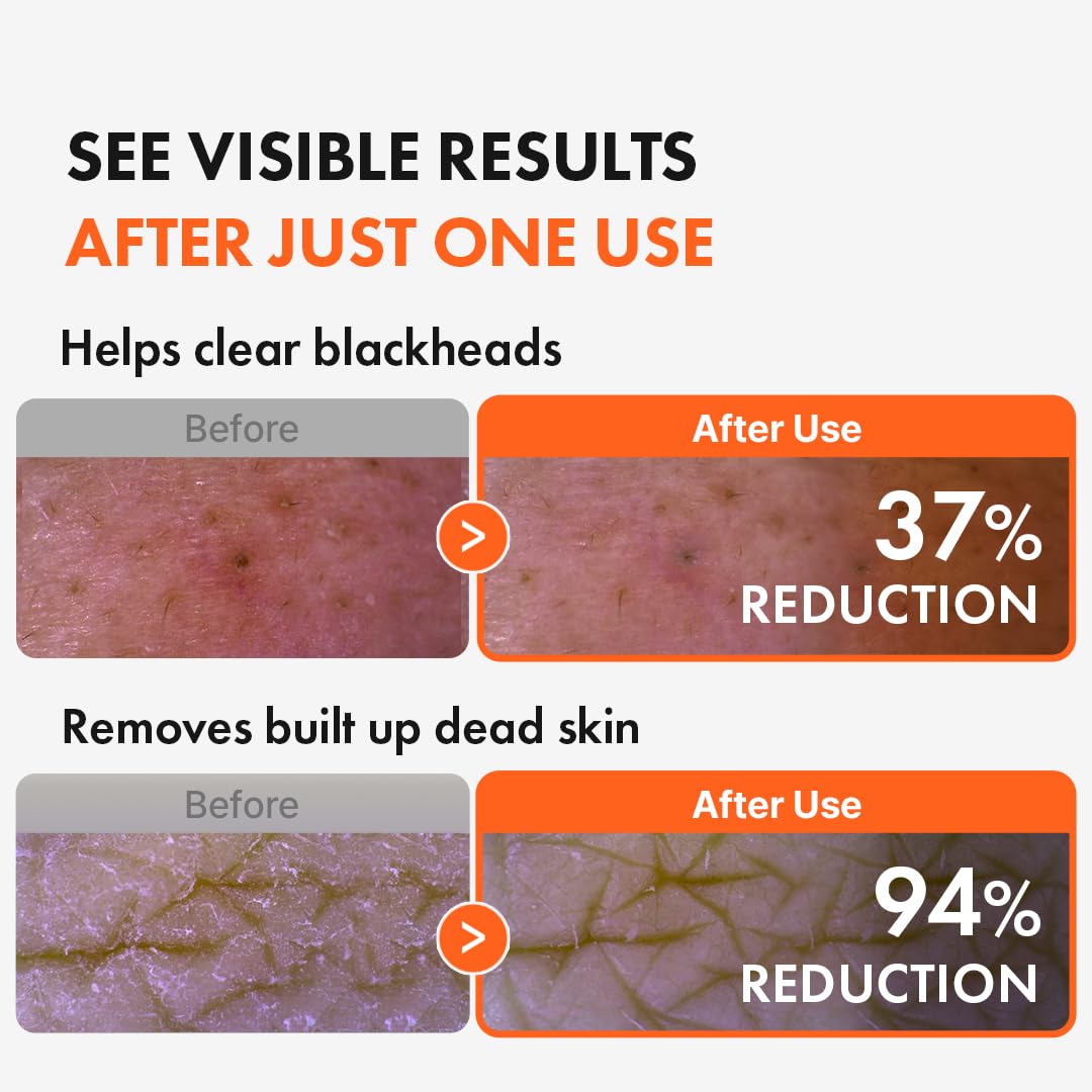 Hanskin AHA Pore Cleansing Oil, exfoliación suave para piel más suave