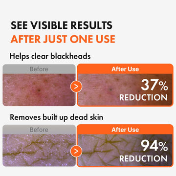 Hanskin AHA Pore Cleansing Oil, exfoliación suave para piel más suave