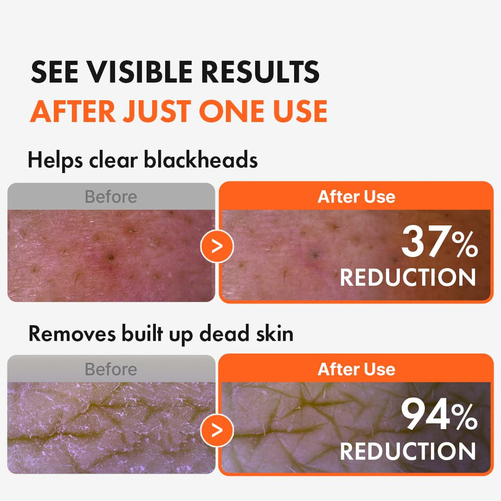 Hanskin AHA Pore Cleansing Oil, exfoliación suave para piel más suave