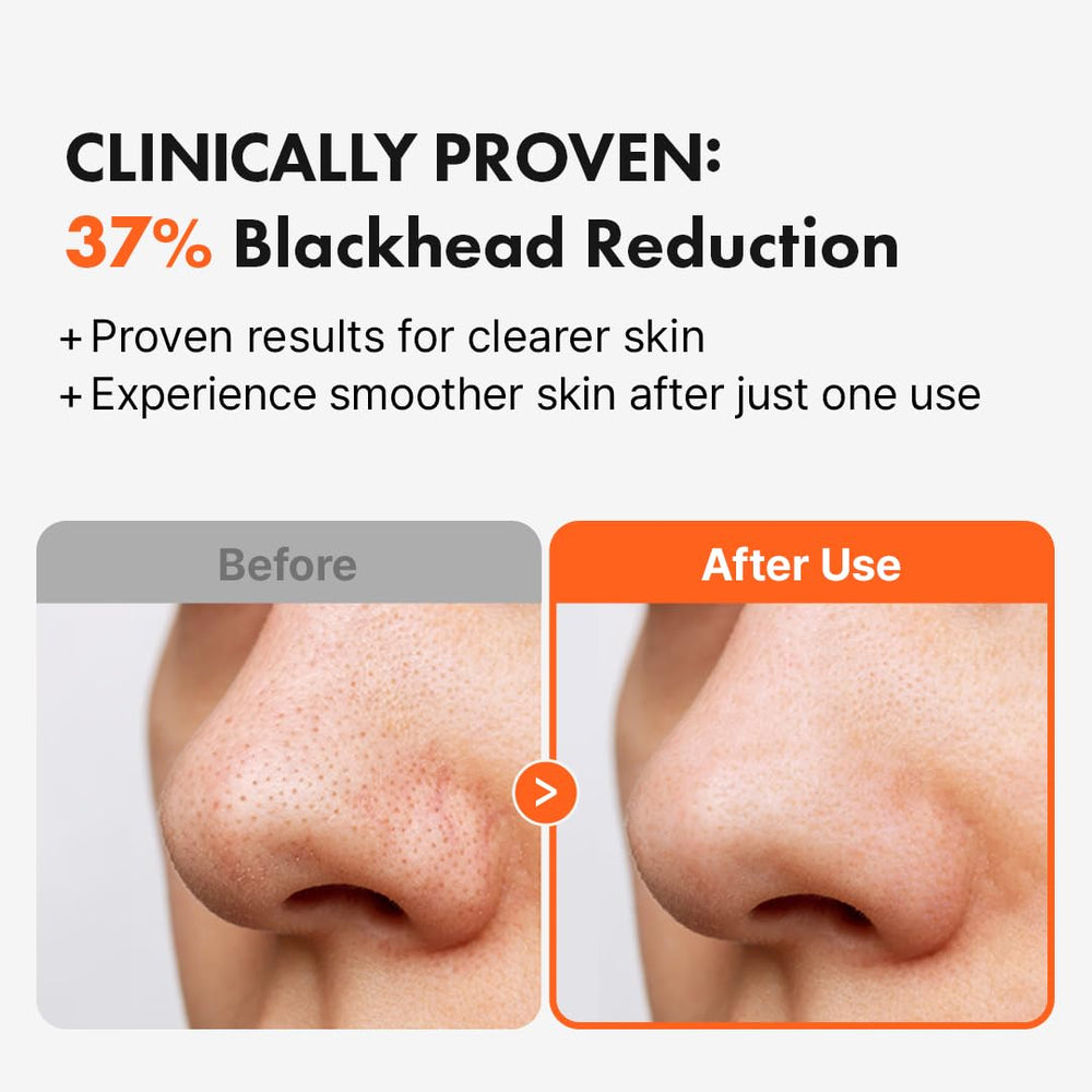 Hanskin AHA Pore Cleansing Oil, limpieza de poros profunda para piel limpia