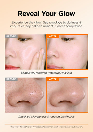 Hanskin AHA Pore Cleansing Balm, primera limpieza que prepara la piel para el cuidado.