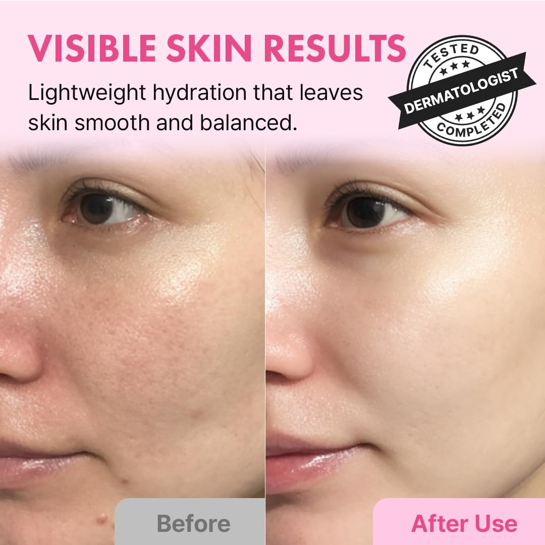 Hanskin Hyaluron Skin Essence Toner, brillo suave para una piel radiante.