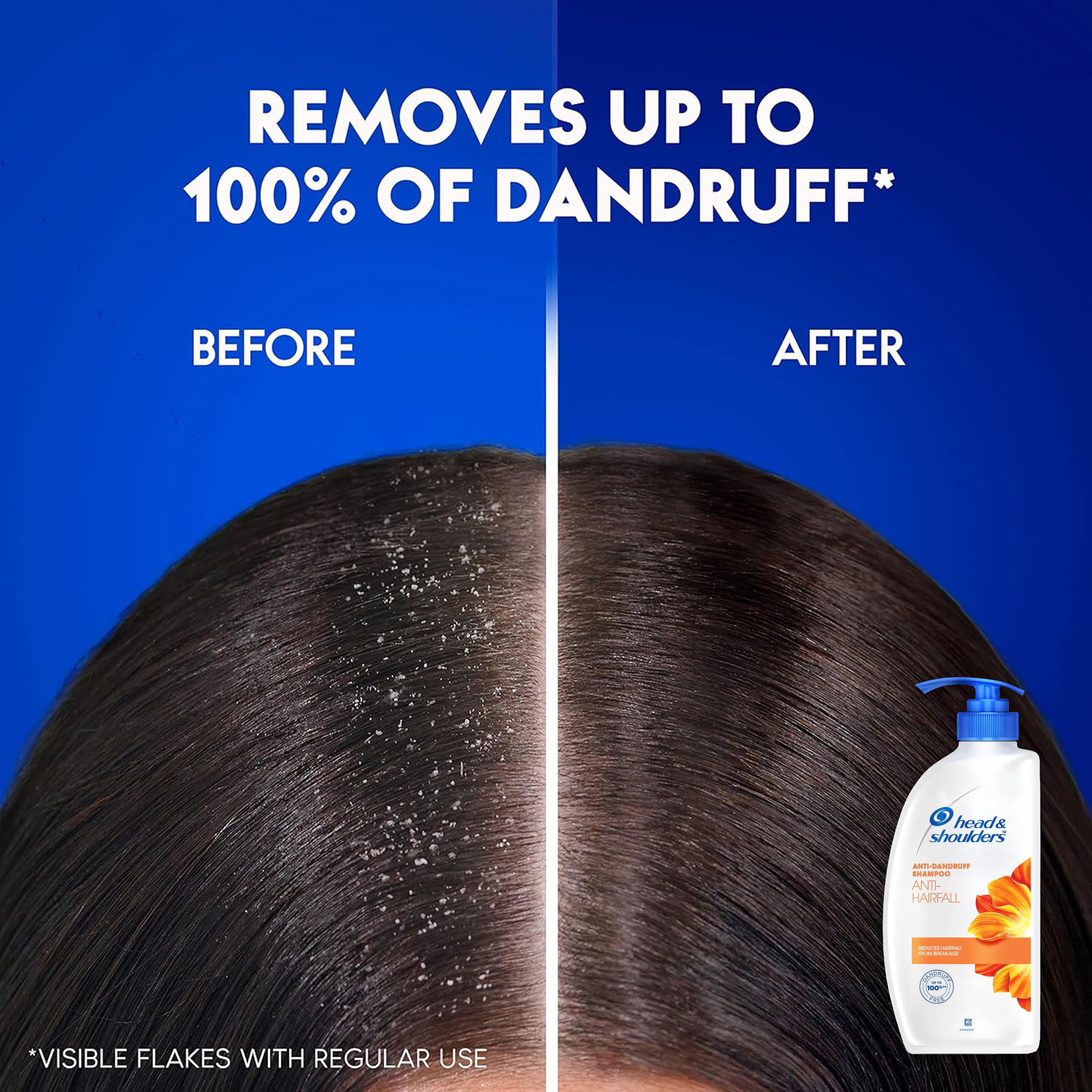 Head & Shoulders champú de uso diario para hombres y mujeres.