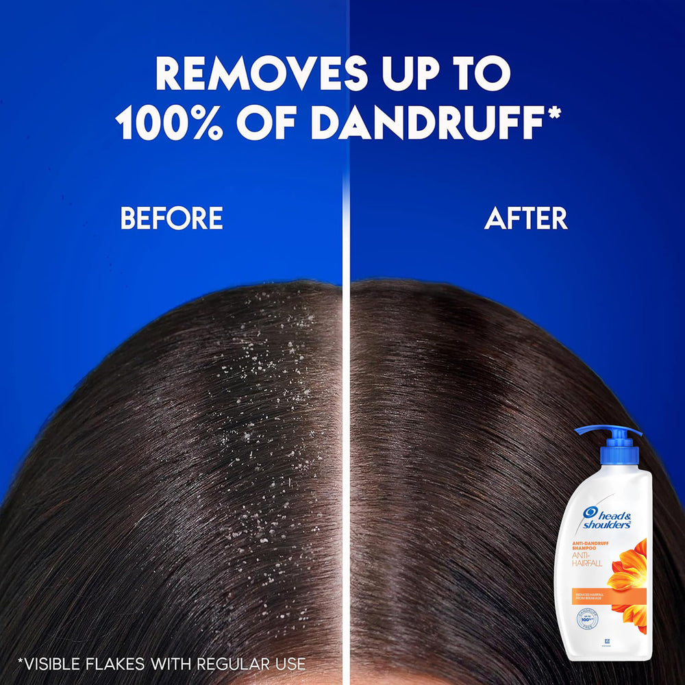 Head & Shoulders champú de uso diario para hombres y mujeres.