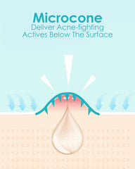 Herolabs Microdart parche, diseño adhesivo que se mantiene durante horas.