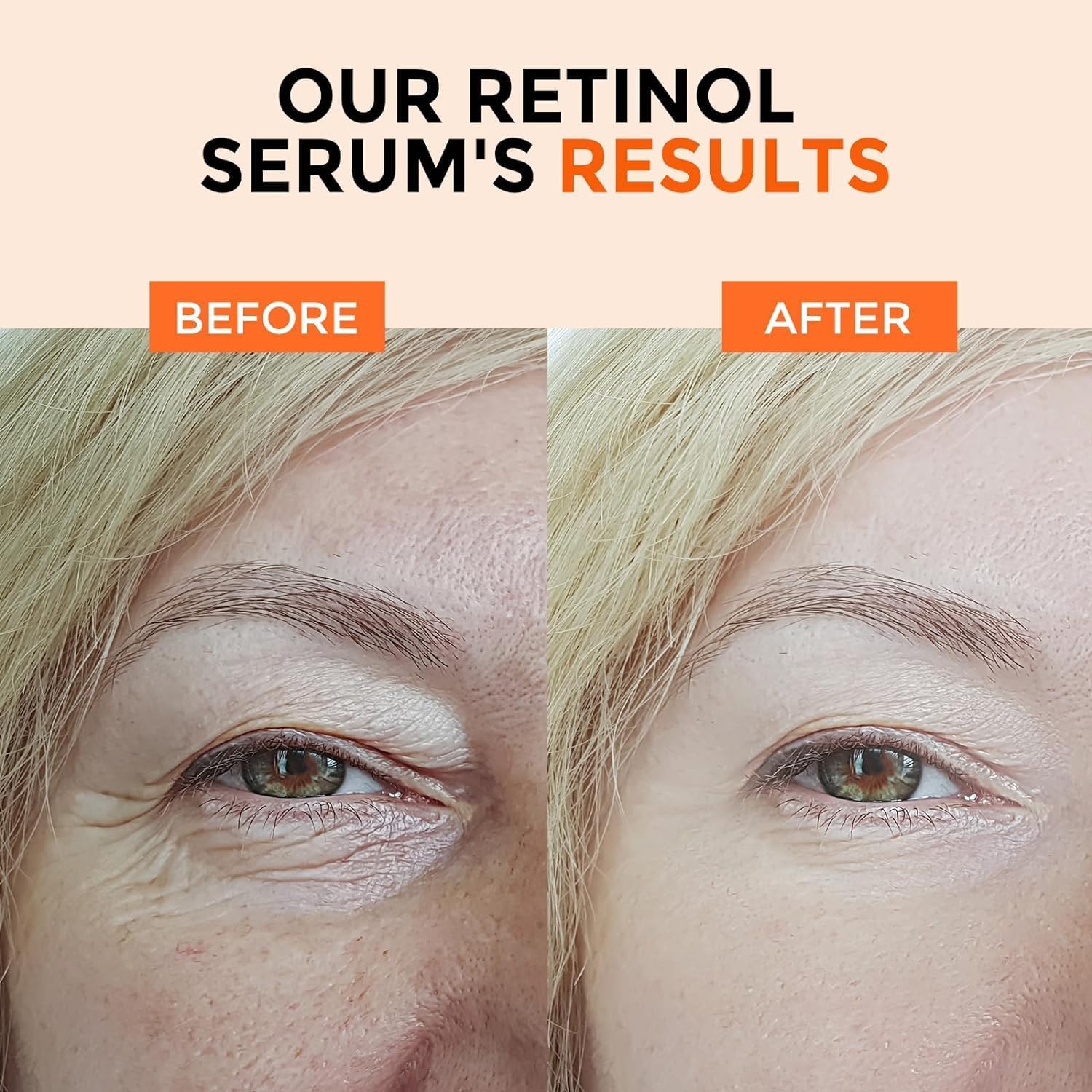 Ingredientes clave B5 vitamina C y E con hialuronato en Herolabs Retinol