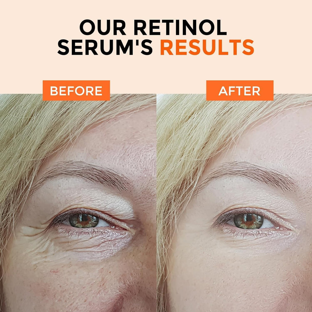 Ingredientes clave B5 vitamina C y E con hialuronato en Herolabs Retinol