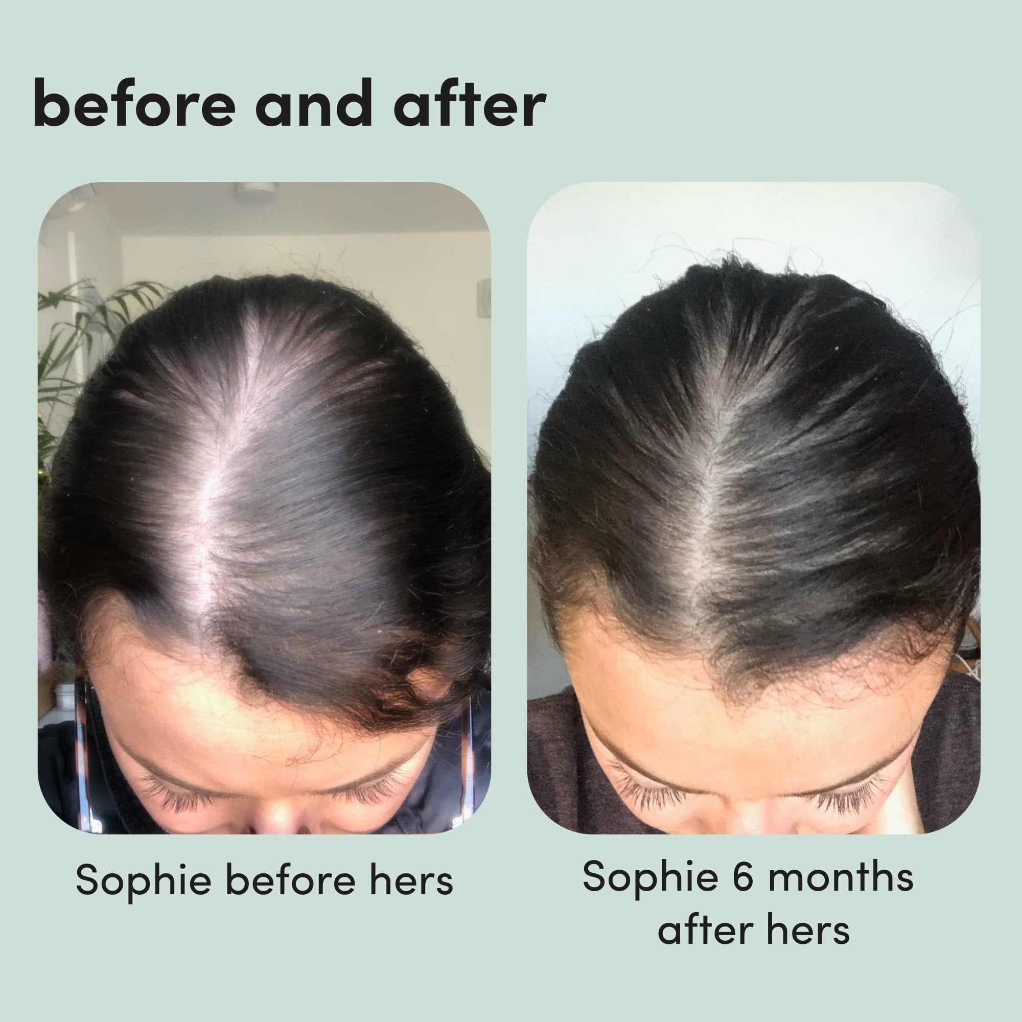 Hers cabello más denso tras uso, posible regeneración.