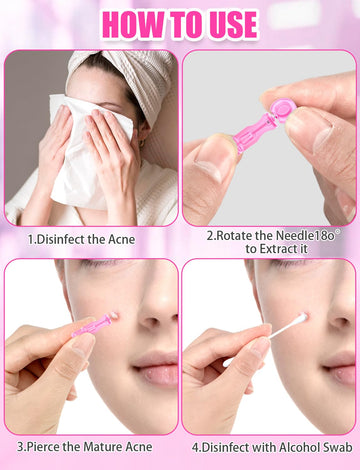 Solución de extracción controlada HFWTWPY para tratar imperfecciones con cuidado