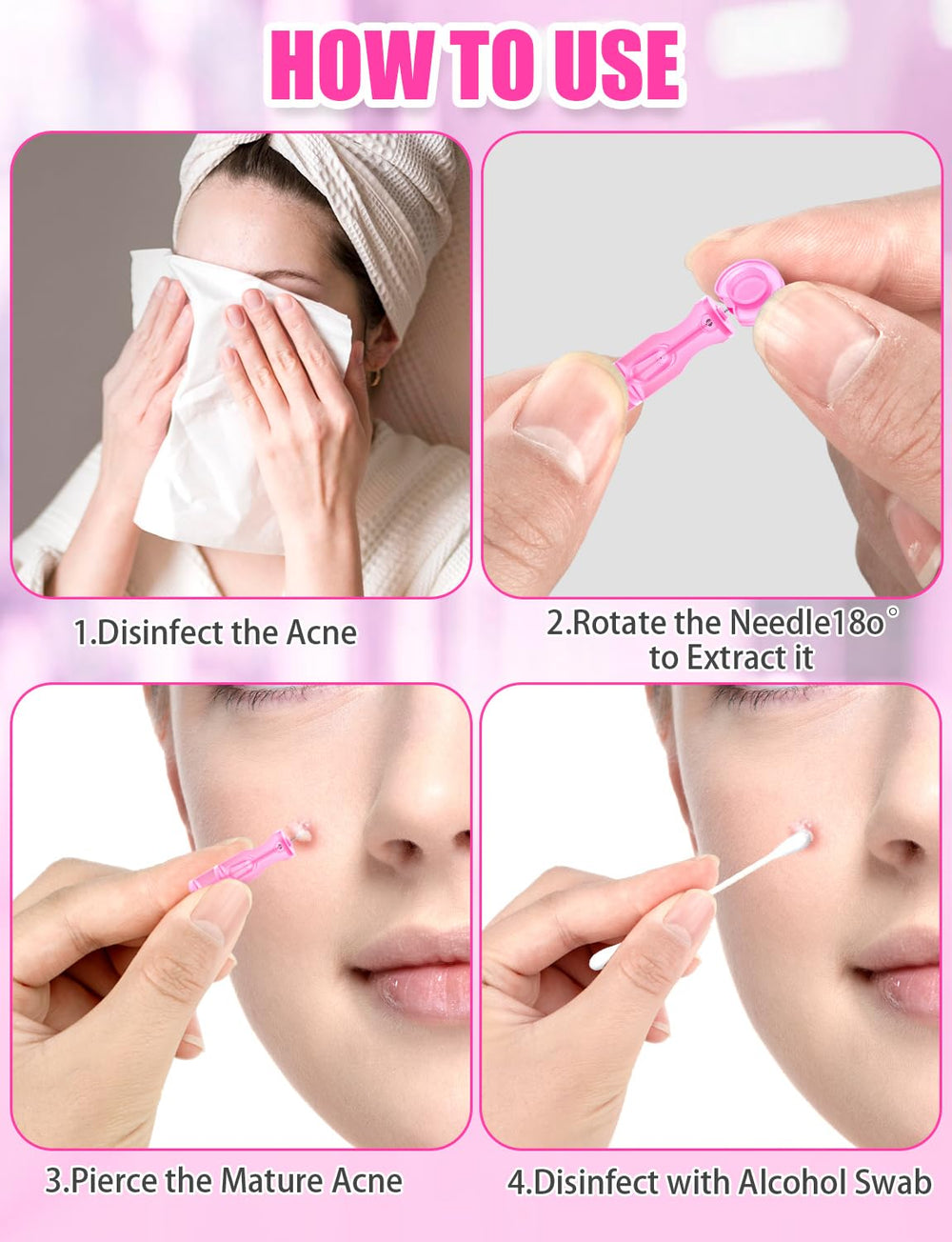 Solución de extracción controlada HFWTWPY para tratar imperfecciones con cuidado