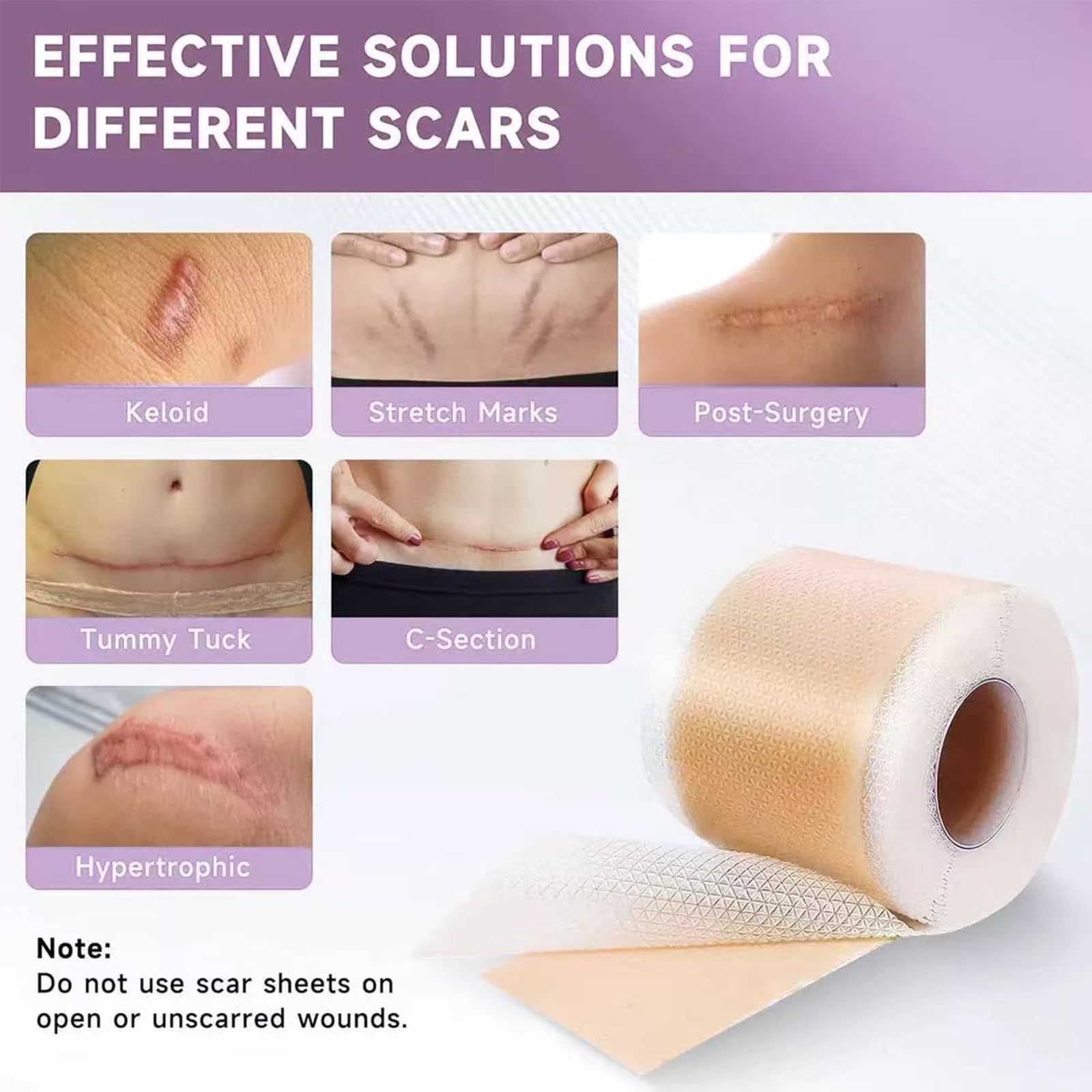 HN LAYXL: cinta silicona abdominoplastia, se adapta a cicatriz extensa.