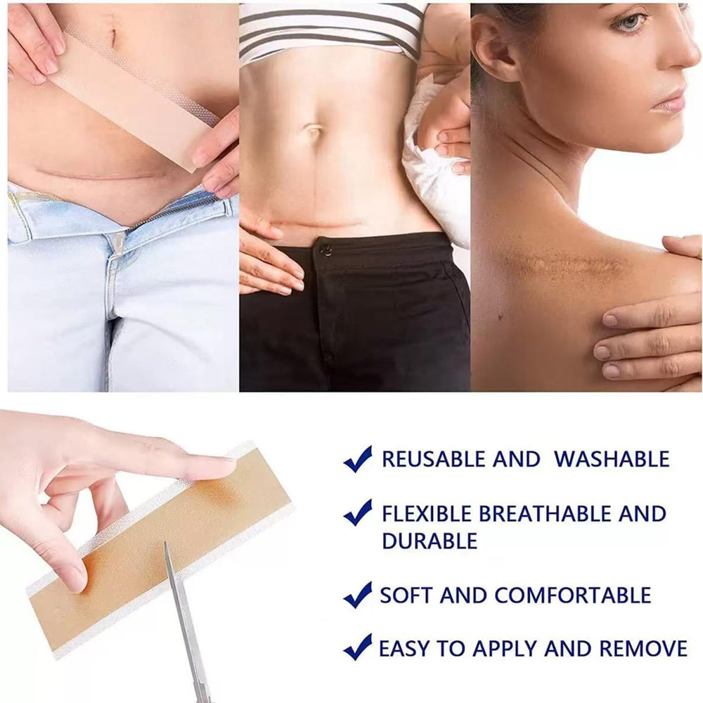 HN LAYXL: cinta silicona quirúrgica para aplicación segura en cicatrices.