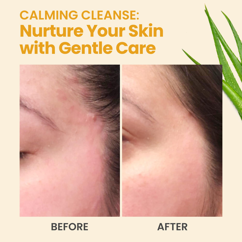 Lavage doux Honeyskin, mousse légère sous la douche.
