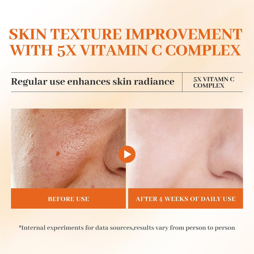 HONLINK 5X Vitamina C Toner efecto refrescante para poros suaves.